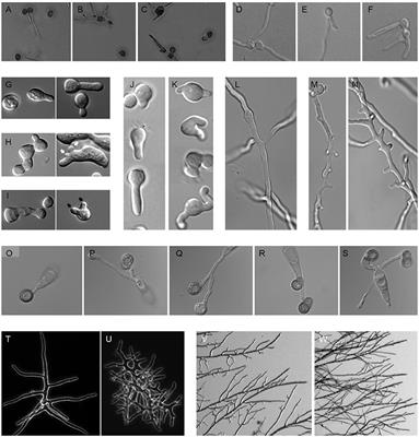 Septins Focus Cellular Growth for Host Infection by Pathogenic Fungi